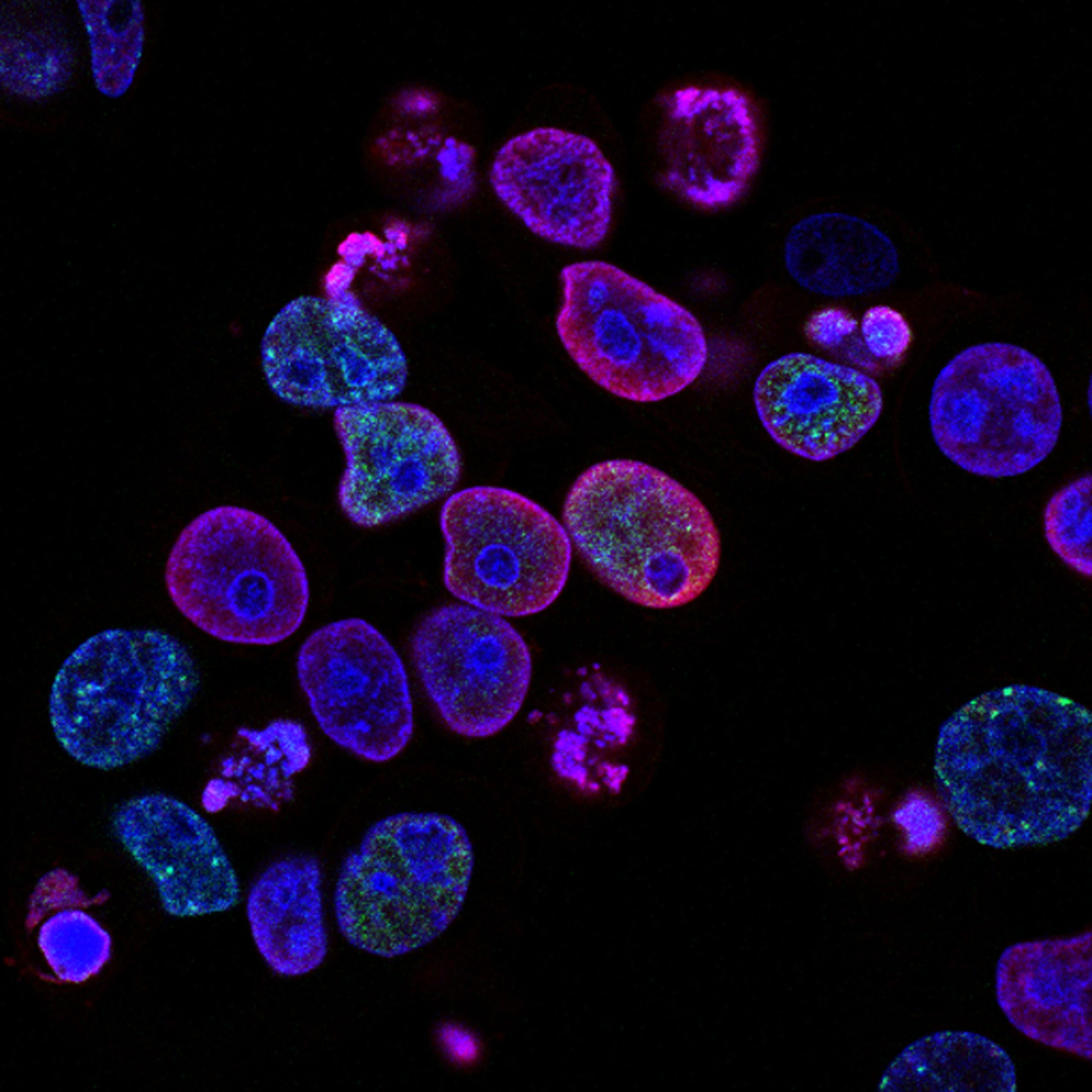 national-cancer-institute-L7en7Lb-Ovc-unsplash national-cancer-institute-L7en7Lb-Ovc-unsplash